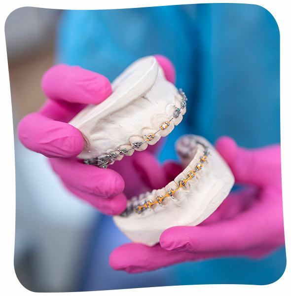 A dentist's hands in pink gloves holding a dental mold with braces fitted on it.