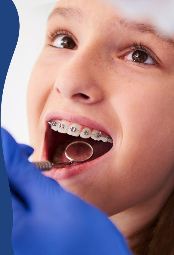 A child with braces looks up as a dentist examines her mouth with a dental mirror.