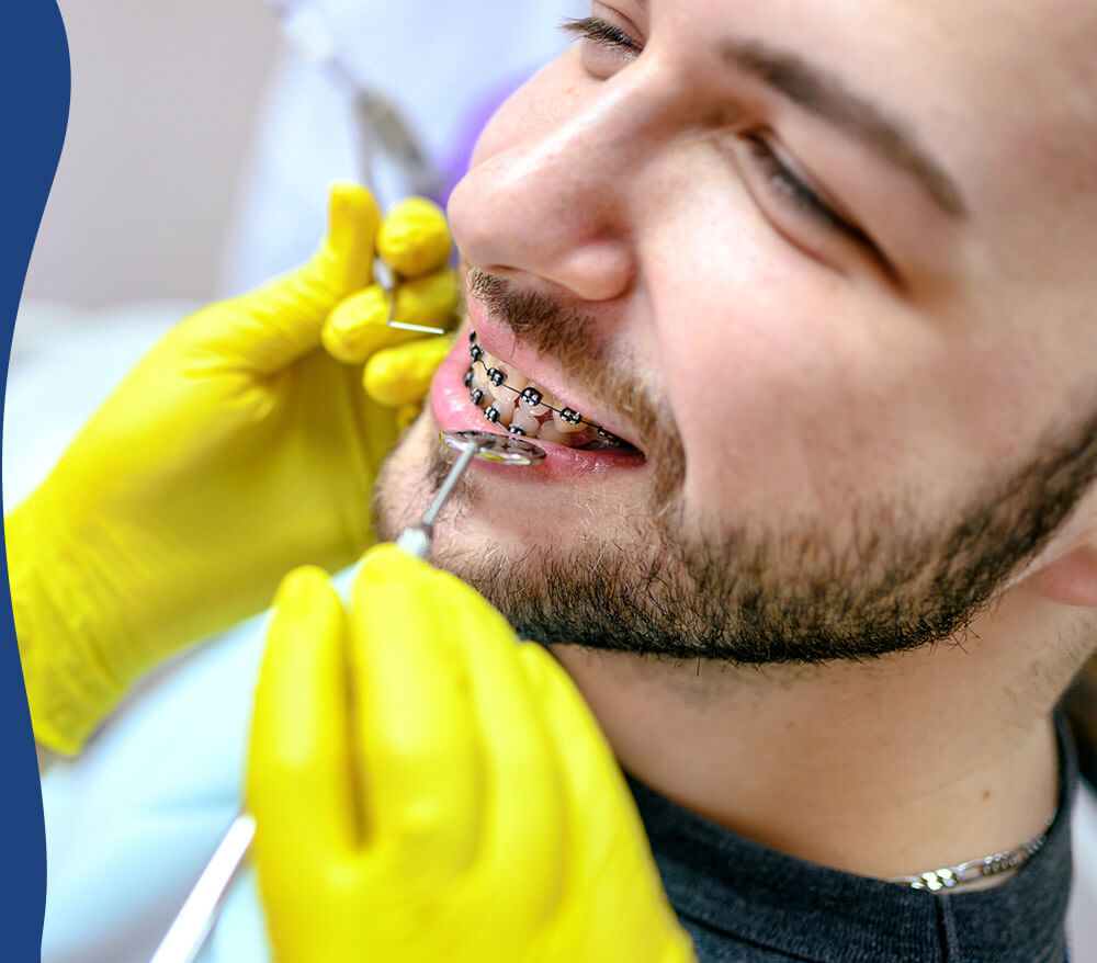 A bearded man receiving orthodontic treatment, with a dentist's hands in yellow gloves adjusting his braces.