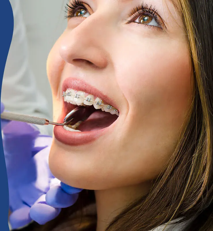 why adults need braces
