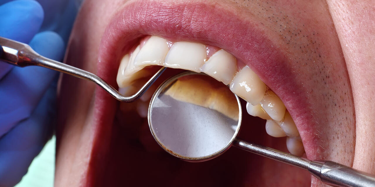 Preventive Dental Treatments: How to Keep Your Smile Healthy