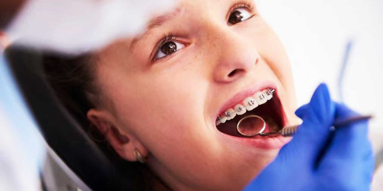 Common Myths About Dental Braces for Adults Explained