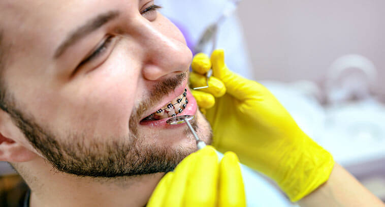 Why More Adults Are Choosing Braces Later in Life