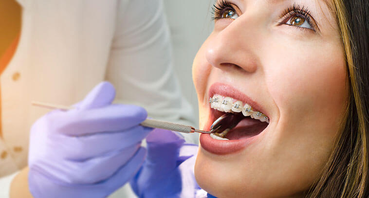 Adult Braces vs Invisalign: Which One is Right for You?