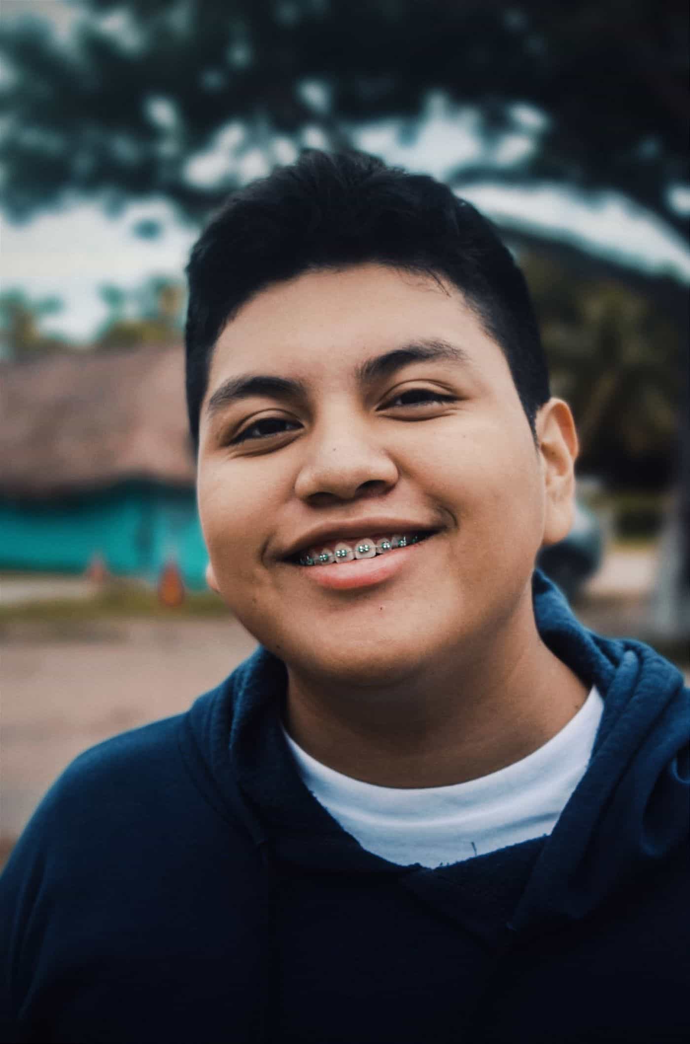 Benefits of braces for teenagers Teenage boy smiling with braces